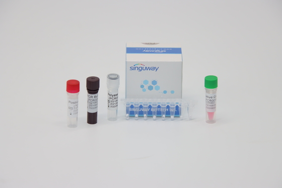 HPV 16 νουκλεϊνικό οξύ 18 ιών που εξετάζει RT PCR την εξάρτηση ISO13485 δοκιμής