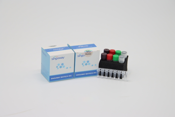 PCR HIV υψηλής ακρίβειας πραγματικές - χρονικό PCR κλινικός πραγματικός εξαρτήσεων POCT IVD - χρονικό διαγνωστικές εξαρτήσεις