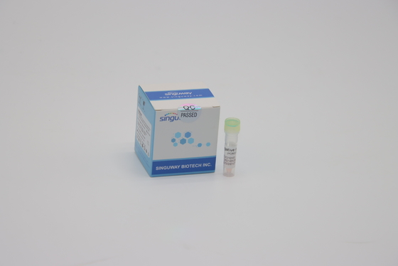 Μια PCR γρίπης βημάτων ρινική εξάρτηση νουκλεϊνικού οξέος δειγμάτων πατσαβουρών CE εξαρτήσεων εξεταστική