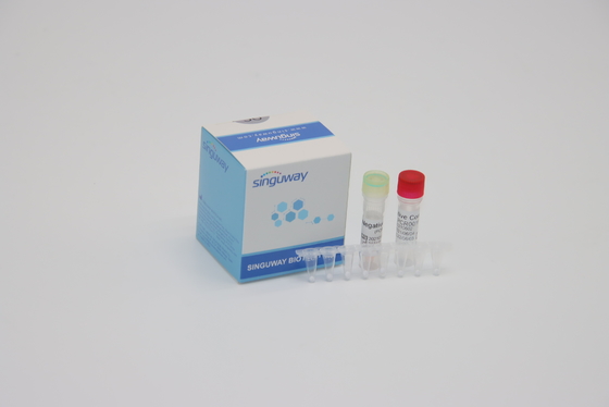 Κλινική διάγνωση IVD πραγματική - χρονικό PCR φθορισμός αντιδραστηρίων που εξετάζει μια PCR βημάτων εξάρτηση