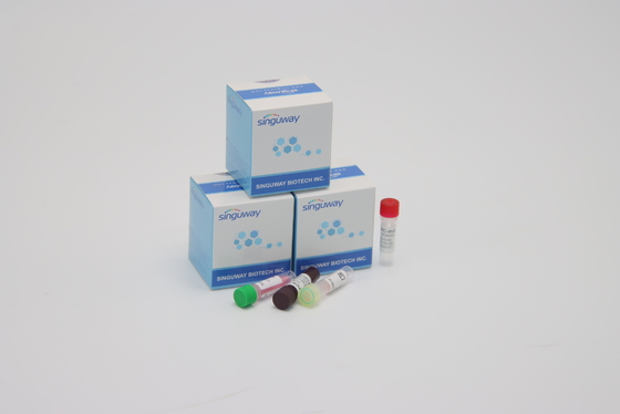 Δοκιμή CE Coronavirus πραγματική - χρονικό PCR διαγνωστικές εξαρτήσεις Ultrafast μέσα σε 30 λεπτά