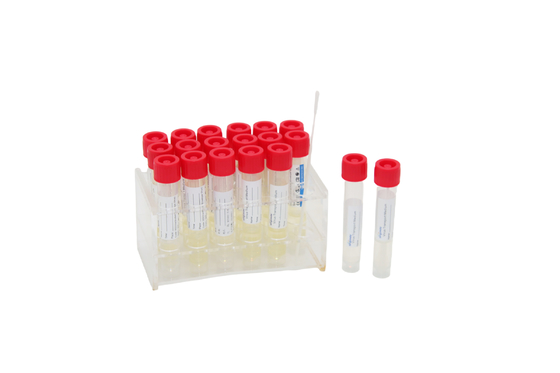 2mL μίας χρήσης ιατρικός VTM δειγματοληψίας ιών σωλήνας δοκιμής εξαρτήσεων με το ραβδί πατσαβουρών λαιμού