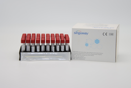 Προερχόμενη από ιό εξάρτηση ISO13485 Singuway εξαγωγής DNA εξαρτήσεων αντιδραστηρίων εξαγωγής απελευθέρωσης δειγμάτων
