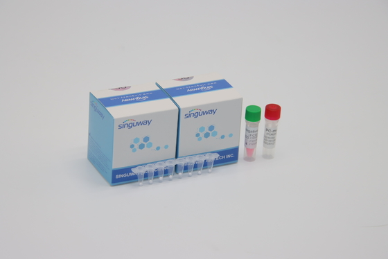 PCR ιών HIV ποσοτική φθορισμού εξάρτηση POCT ανίχνευσης πραγματική - χρονικό CE