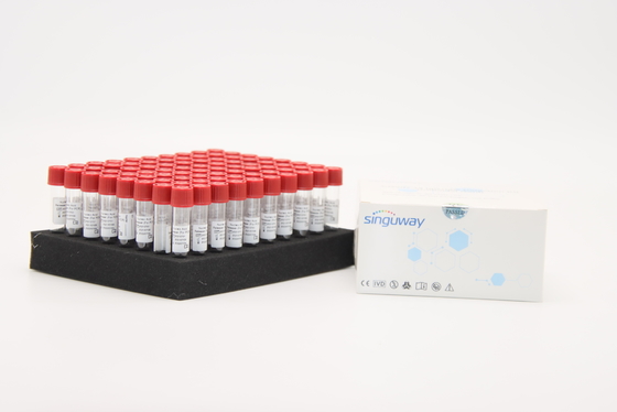 PCR Singuway εξάρτηση εξαγωγής RNA αντιδραστηρίων απελευθέρωσης δειγμάτων ιών της γρίπης δοκιμής
