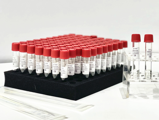 Μια PCR αντιδραστηρίων απελευθέρωσης δειγμάτων βημάτων εξάρτηση εξαγωγής από την υπομονετική πατσαβούρα φαρύγγων