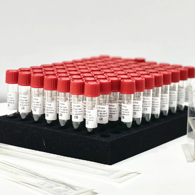 Ρινικός σωλήνας εξαρτήσεων 0.5mL/εξαγωγής αντιδραστηρίων απελευθέρωσης δειγμάτων πατσαβουρών φαρύγγων χωρίς προεπεξεργασία